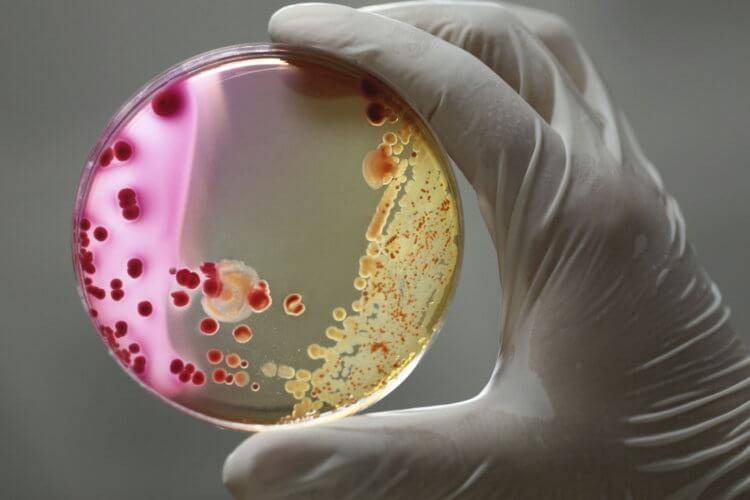 Где живет наибольшее количество бактерий? разное - 2022